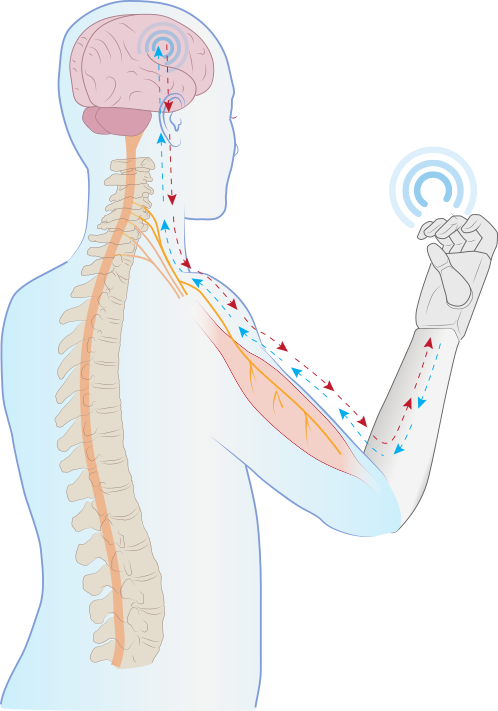 prosthetic feedback drawing